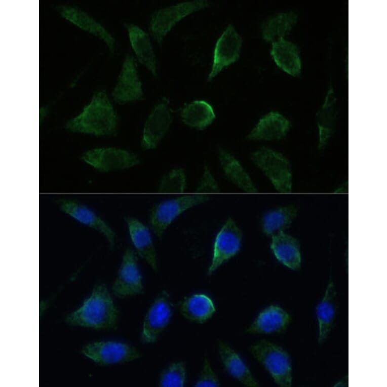Immunofluorescence - Anti-GK2 Antibody (A306809) - Antibodies.com