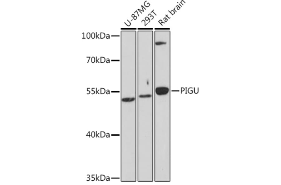 Western Blot - Anti-Pigu Antibody (A306810) - Antibodies.com