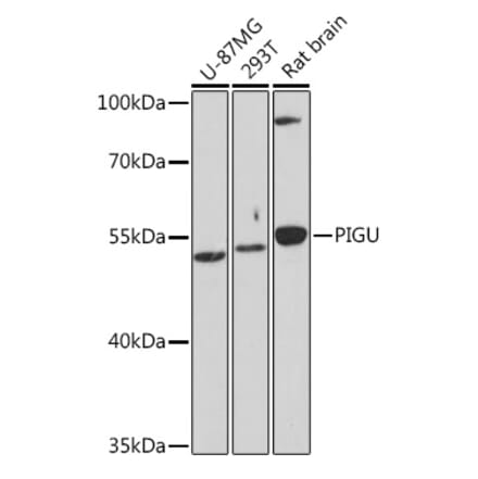 Western Blot - Anti-Pigu Antibody (A306810) - Antibodies.com