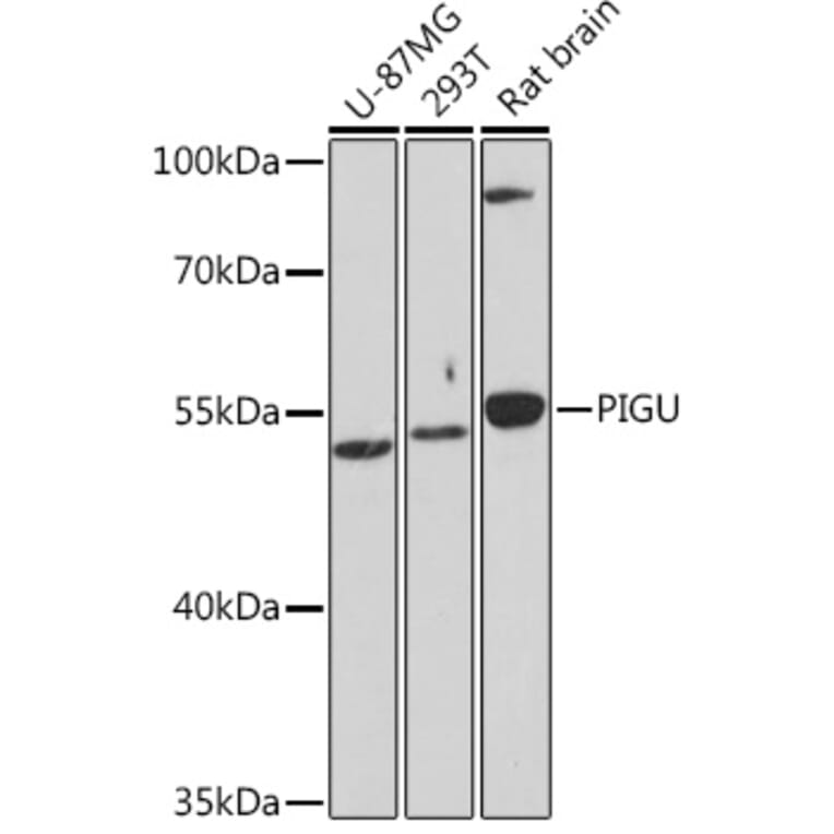 Western Blot - Anti-Pigu Antibody (A306810) - Antibodies.com