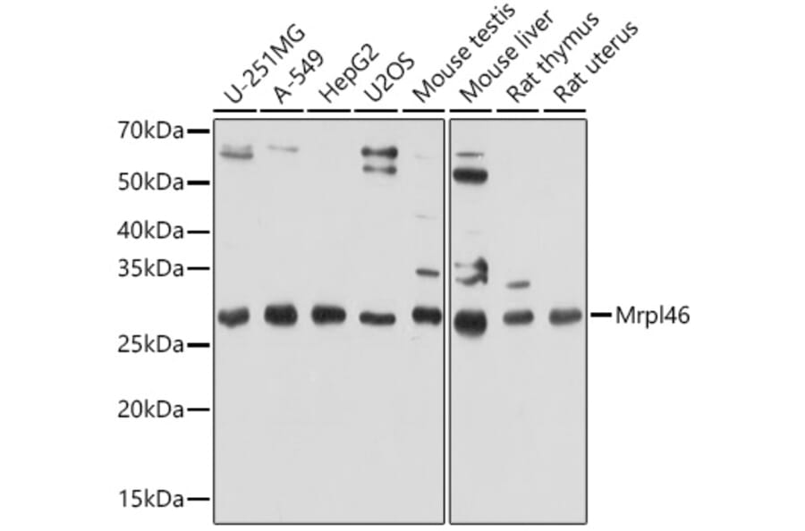 Western Blot - Anti-Mrpl46 Antibody (A306811) - Antibodies.com