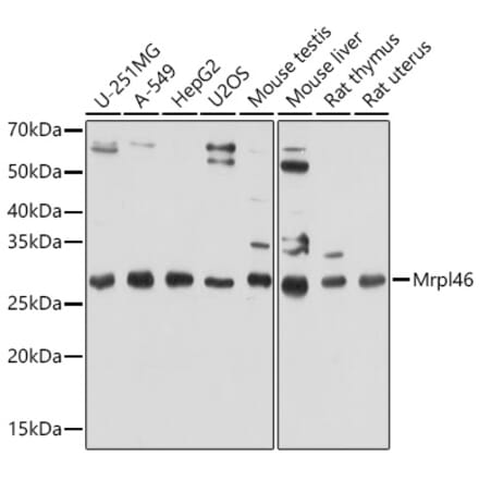 Western Blot - Anti-Mrpl46 Antibody (A306811) - Antibodies.com