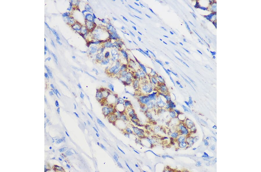 Immunohistochemistry - Anti-Mrpl46 Antibody (A306811) - Antibodies.com