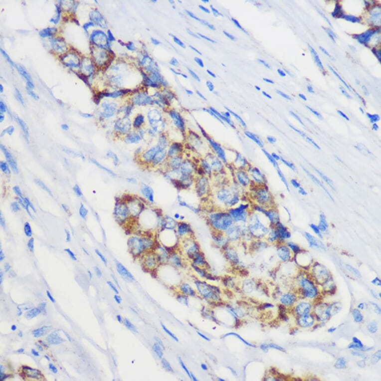 Immunohistochemistry - Anti-Mrpl46 Antibody (A306811) - Antibodies.com