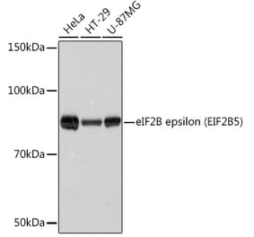 Western Blot - Anti-EIF2B5 Antibody [ARC1774] (A306812) - Antibodies.com