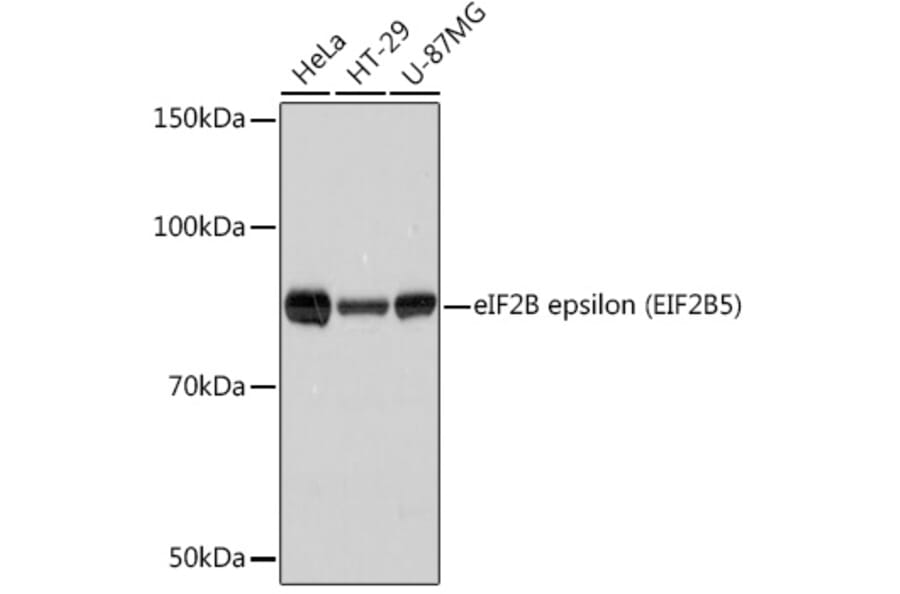 Western Blot - Anti-EIF2B5 Antibody [ARC1774] (A306812) - Antibodies.com