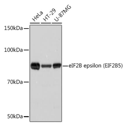 Western Blot - Anti-EIF2B5 Antibody [ARC1774] (A306812) - Antibodies.com