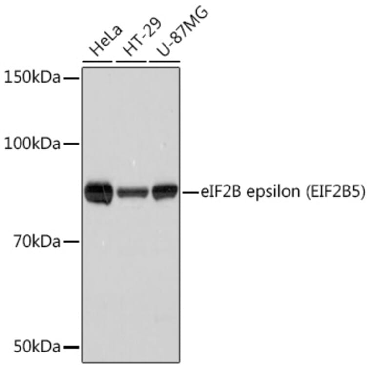 Western Blot - Anti-EIF2B5 Antibody [ARC1774] (A306812) - Antibodies.com