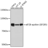 Western Blot - Anti-EIF2B5 Antibody [ARC1774] (A306812) - Antibodies.com