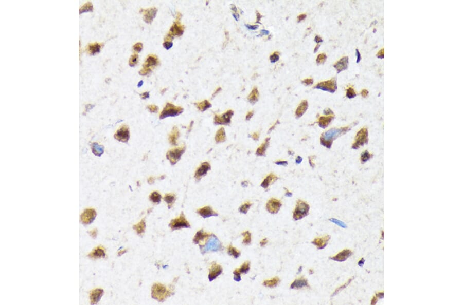 Immunohistochemistry - Anti-EIF2B5 Antibody [ARC1774] (A306812) - Antibodies.com