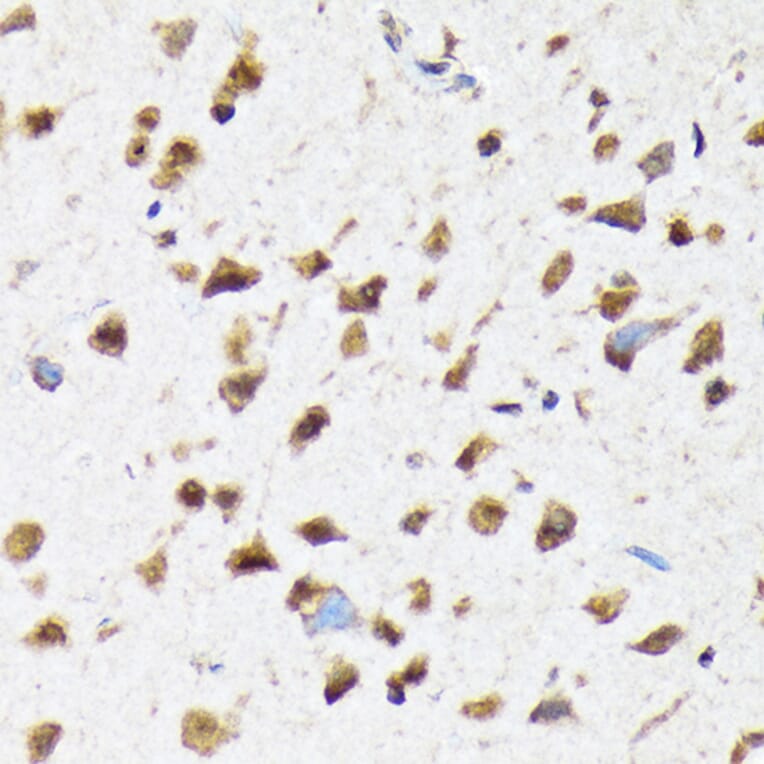 Immunohistochemistry - Anti-EIF2B5 Antibody [ARC1774] (A306812) - Antibodies.com