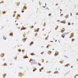 Immunohistochemistry - Anti-EIF2B5 Antibody [ARC1774] (A306812) - Antibodies.com