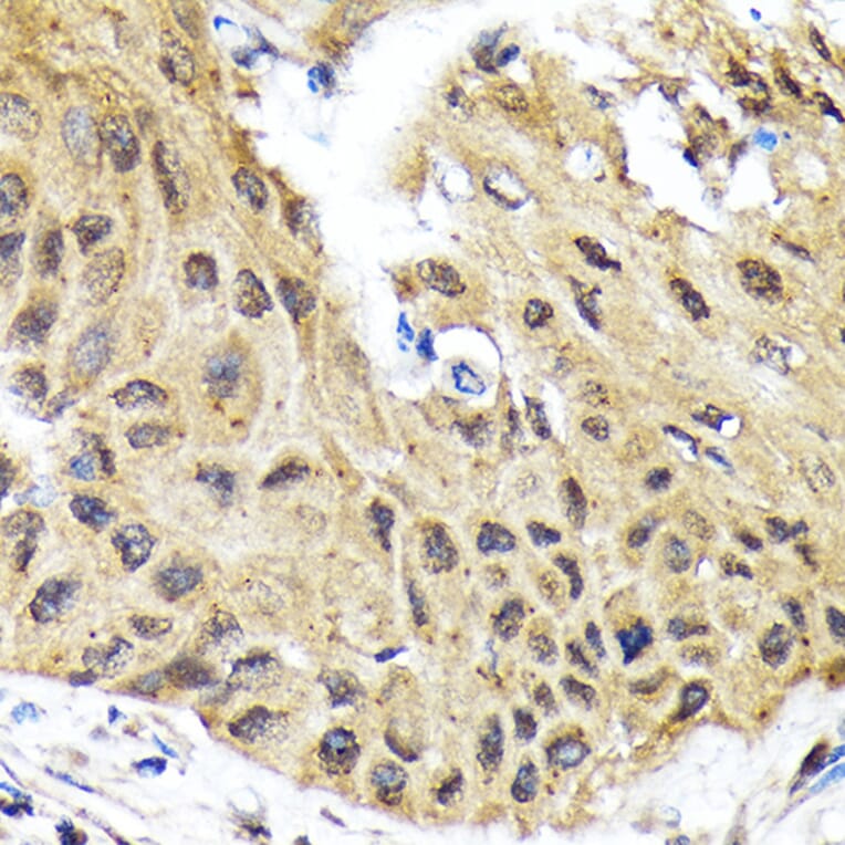 Immunohistochemistry - Anti-EIF2B5 Antibody [ARC1774] (A306812) - Antibodies.com