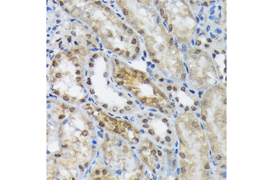 Immunohistochemistry - Anti-EIF2B5 Antibody [ARC1774] (A306812) - Antibodies.com