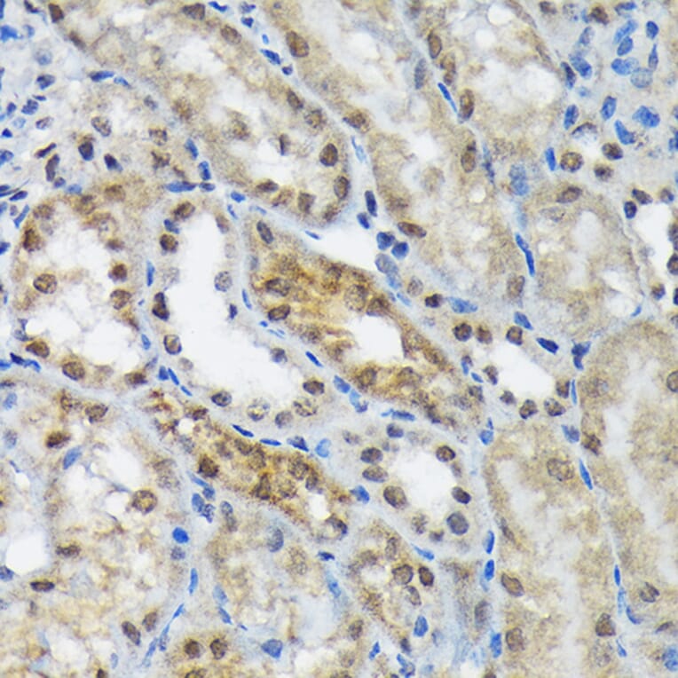 Immunohistochemistry - Anti-EIF2B5 Antibody [ARC1774] (A306812) - Antibodies.com