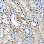 Immunohistochemistry - Anti-EIF2B5 Antibody [ARC1774] (A306812) - Antibodies.com