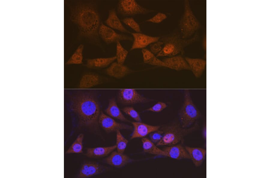 Immunofluorescence - Anti-EIF2B5 Antibody [ARC1774] (A306812) - Antibodies.com