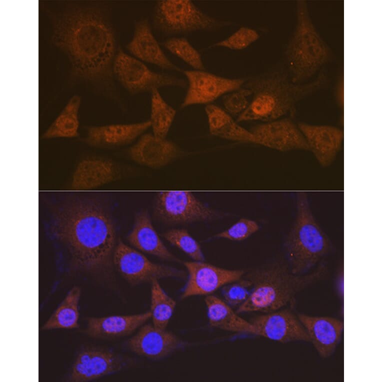 Immunofluorescence - Anti-EIF2B5 Antibody [ARC1774] (A306812) - Antibodies.com