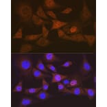 Immunofluorescence - Anti-EIF2B5 Antibody [ARC1774] (A306812) - Antibodies.com