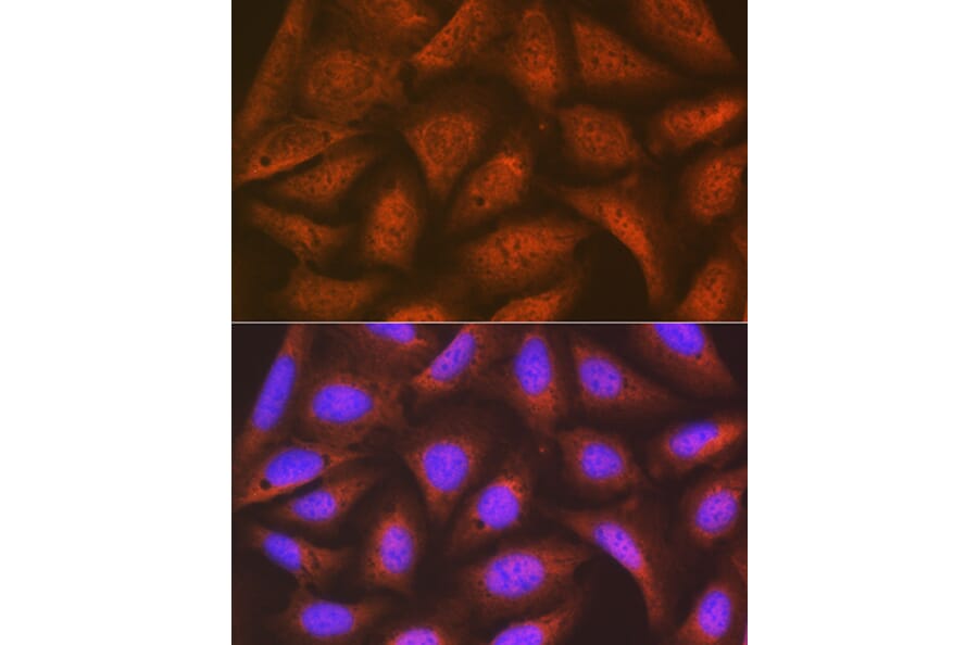 Immunofluorescence - Anti-EIF2B5 Antibody [ARC1774] (A306812) - Antibodies.com
