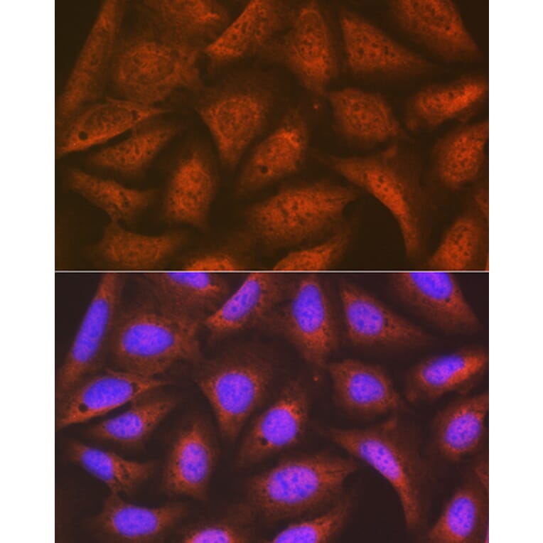 Immunofluorescence - Anti-EIF2B5 Antibody [ARC1774] (A306812) - Antibodies.com
