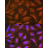 Immunofluorescence - Anti-EIF2B5 Antibody [ARC1774] (A306812) - Antibodies.com