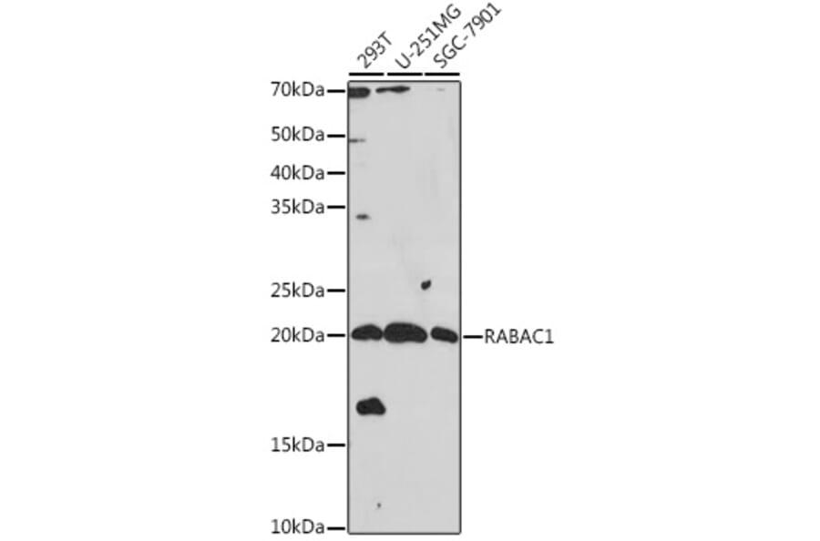 Western Blot - Anti-PRA1 Antibody (A306813) - Antibodies.com