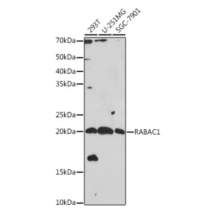 Western Blot - Anti-PRA1 Antibody (A306813) - Antibodies.com