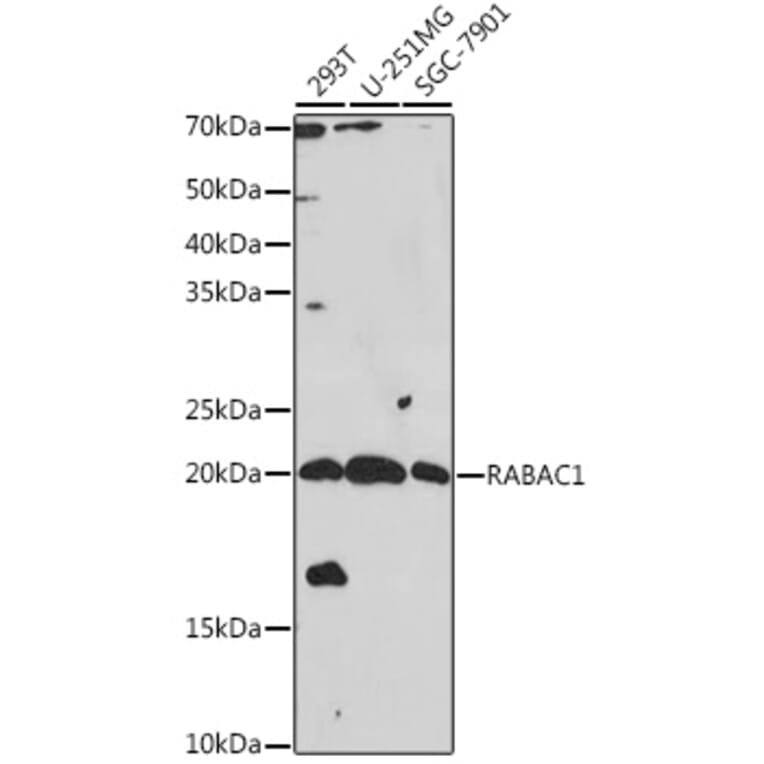 Western Blot - Anti-PRA1 Antibody (A306813) - Antibodies.com