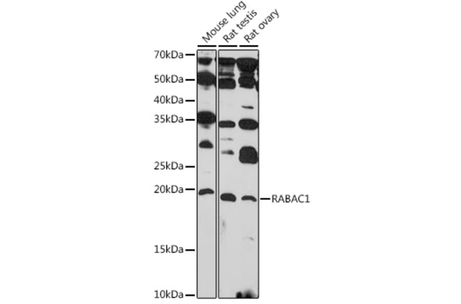 Western Blot - Anti-PRA1 Antibody (A306813) - Antibodies.com
