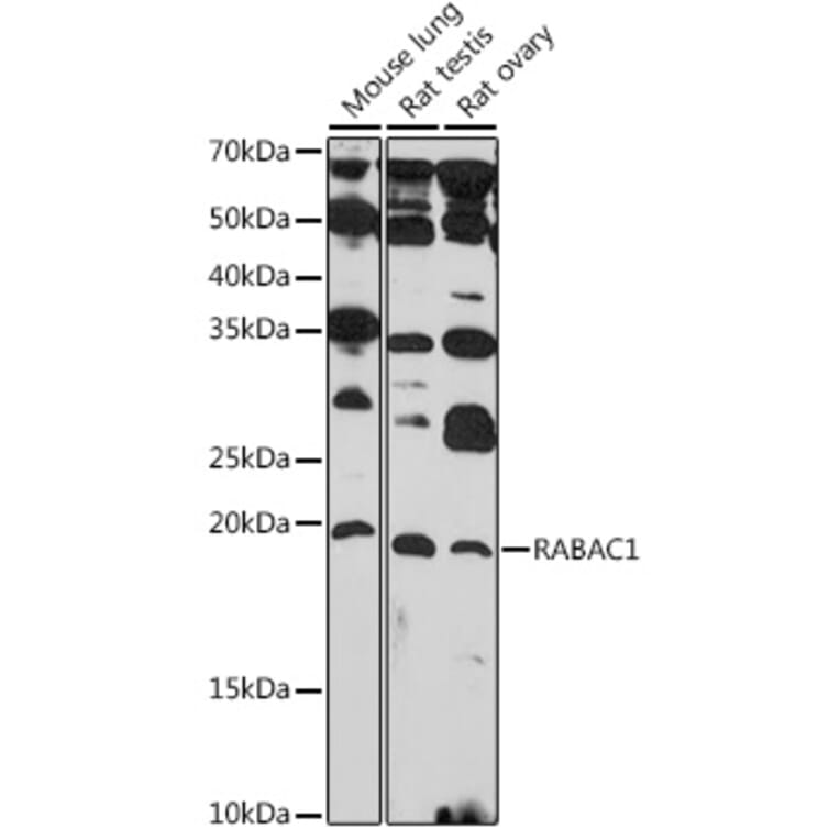 Western Blot - Anti-PRA1 Antibody (A306813) - Antibodies.com