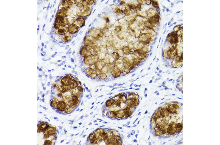 Immunohistochemistry - Anti-Trefoil Factor 3 Antibody [ARC2664] (A306815) - Antibodies.com