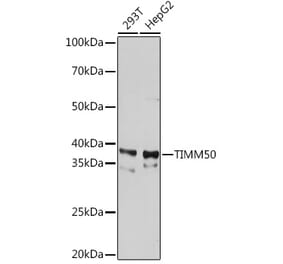 Western Blot - Anti-TIM50 Antibody [ARC1883] (A306816) - Antibodies.com