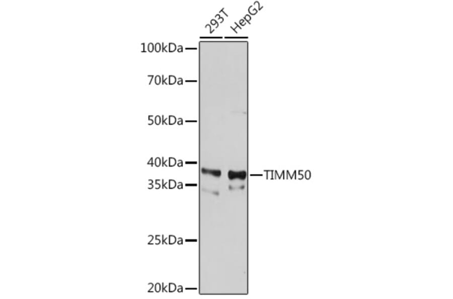 Western Blot - Anti-TIM50 Antibody [ARC1883] (A306816) - Antibodies.com