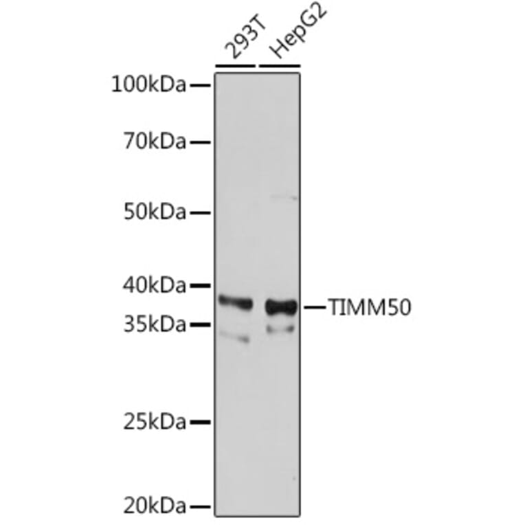 Western Blot - Anti-TIM50 Antibody [ARC1883] (A306816) - Antibodies.com