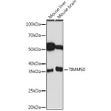Western Blot - Anti-TIM50 Antibody [ARC1883] (A306816) - Antibodies.com