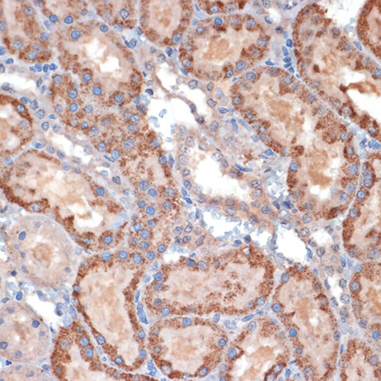 Immunohistochemistry - Anti-TIM50 Antibody (A306816) - Antibodies.com