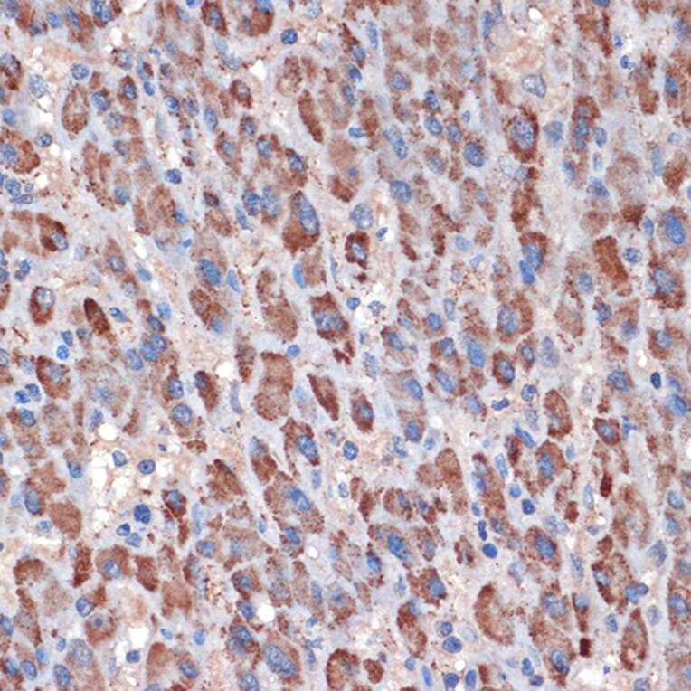 Immunohistochemistry - Anti-TIM50 Antibody [ARC1883] (A306816) - Antibodies.com
