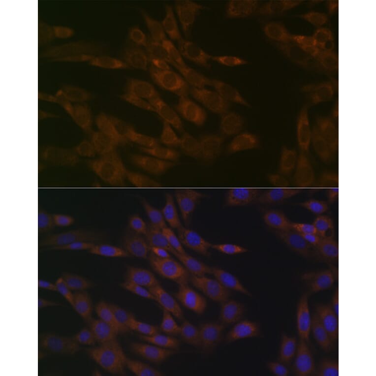 Immunofluorescence - Anti-TIM50 Antibody [ARC1883] (A306816) - Antibodies.com