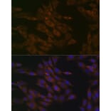 Immunofluorescence - Anti-TIM50 Antibody [ARC1883] (A306816) - Antibodies.com