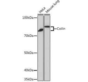 Western Blot - Anti-Coilin Antibody [ARC0785] (A306817) - Antibodies.com