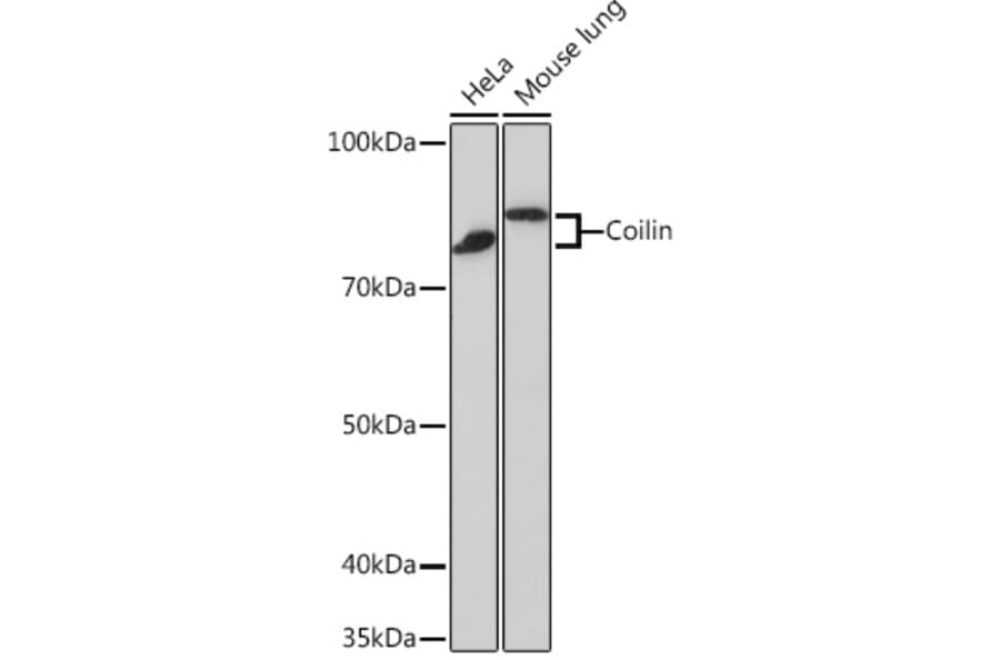 Western Blot - Anti-Coilin Antibody [ARC0785] (A306817) - Antibodies.com