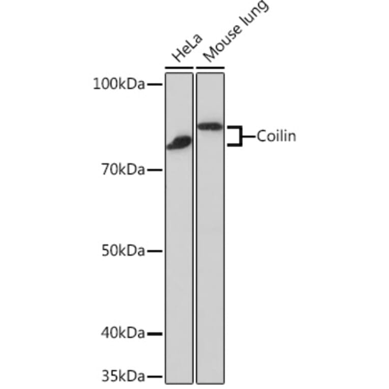 Western Blot - Anti-Coilin Antibody [ARC0785] (A306817) - Antibodies.com