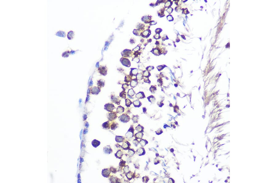Immunohistochemistry - Anti-JAB1 Antibody [ARC0895] (A306818) - Antibodies.com