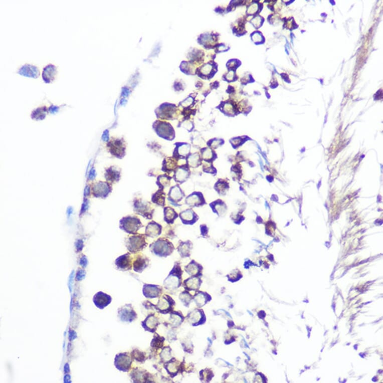 Immunohistochemistry - Anti-JAB1 Antibody [ARC0895] (A306818) - Antibodies.com