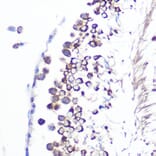 Immunohistochemistry - Anti-JAB1 Antibody [ARC0895] (A306818) - Antibodies.com