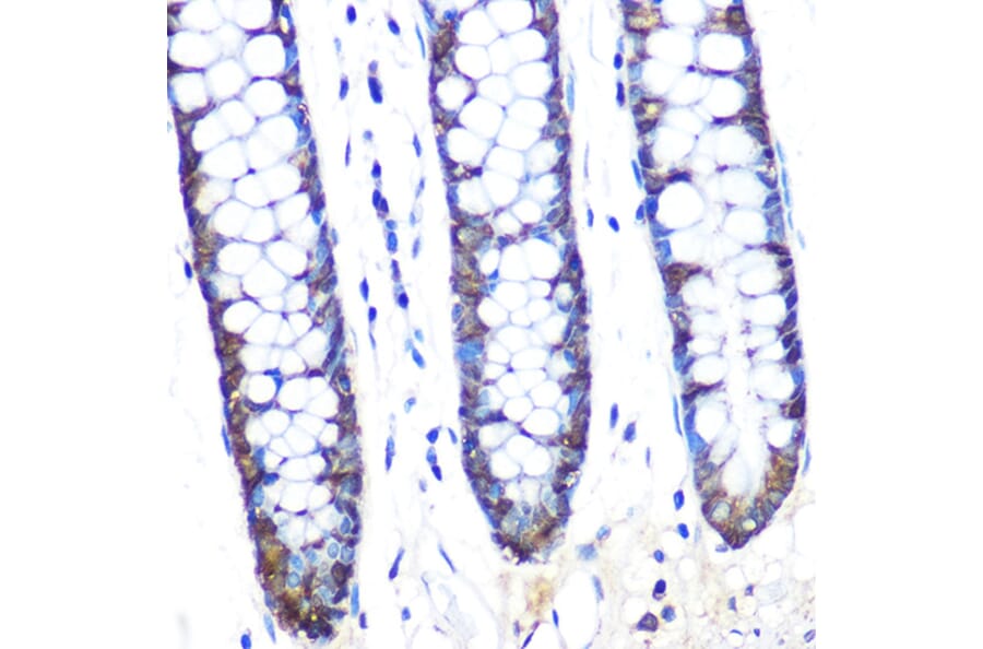 Immunohistochemistry - Anti-JAB1 Antibody [ARC0895] (A306818) - Antibodies.com