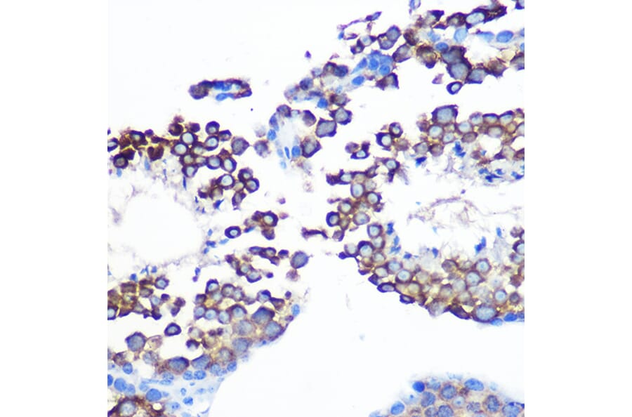 Immunohistochemistry - Anti-JAB1 Antibody [ARC0895] (A306818) - Antibodies.com