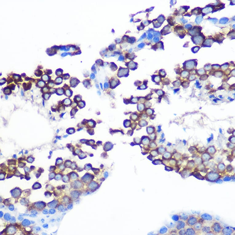 Immunohistochemistry - Anti-JAB1 Antibody [ARC0895] (A306818) - Antibodies.com