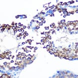 Immunohistochemistry - Anti-JAB1 Antibody [ARC0895] (A306818) - Antibodies.com